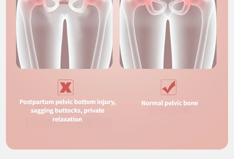 Dijbeen- en bekkenbodemtrainer